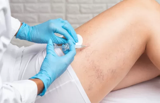 Atardamar Hastaliklari Tedavisi 1