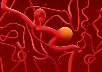 Damar Anevrizmaları Nasıl Olur?