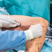 Damar Cerrahisi Doktoru 13