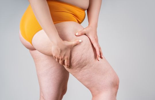 Lipodem Tedavisi 3