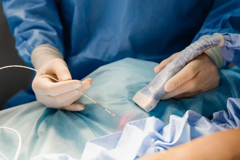 radyofrekans varis tedavisi