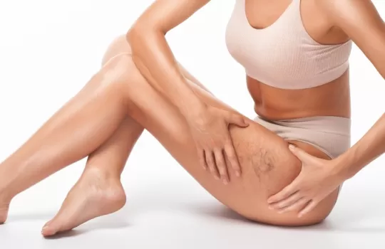 Toplardamar Hastaliklari Tedavisi 1