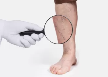 Varis Tedavisinde Erken Teşhis ve Tanının Önemi