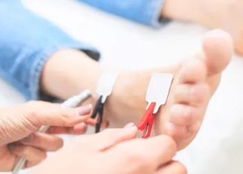 Diyabetik Ayak Yaralarında Kök Hücre Tedavisi