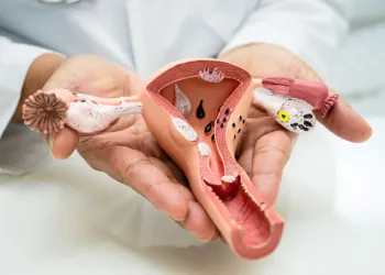 Pelvik Venöz Konjesyon: Kadınlarda Genital Varis ve Tedavi Yaklaşımı