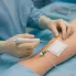 Varis için Endovenöz Radyofrekans Ablasyon Tedavisi