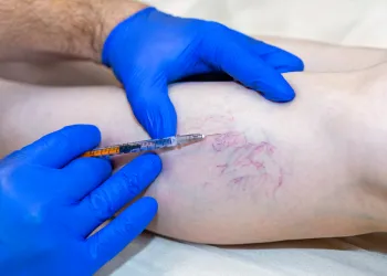 Varis Tedavisinde En İyi Yöntem Hangisi? Doğru Karar İçin Altın Standartlar